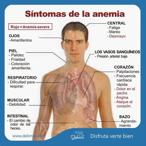 sintomas de anemia en adultos